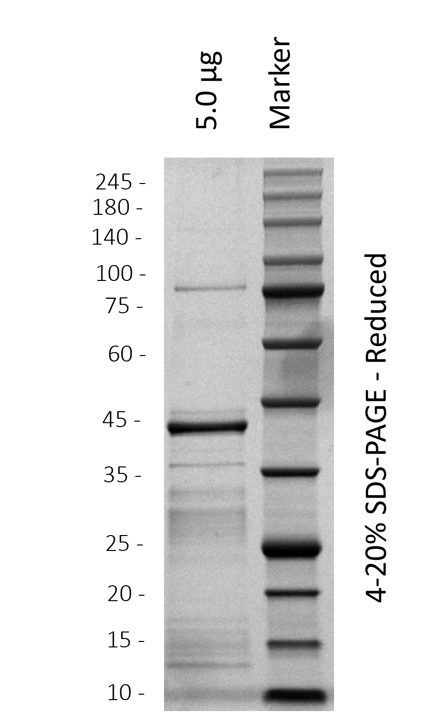 Human HOXA5 (WT)