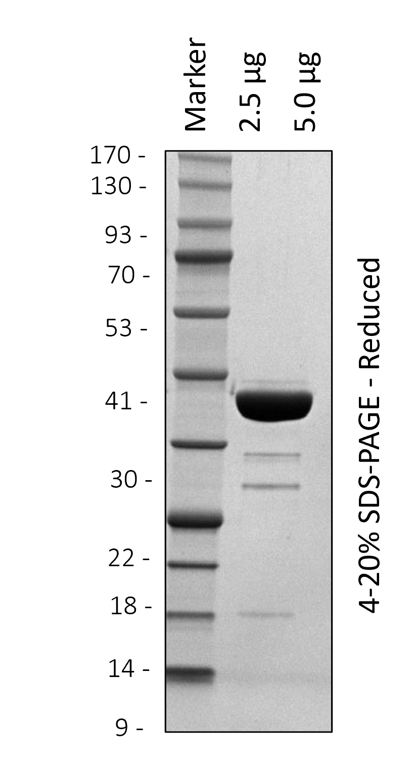 Human p38 (1-360)
