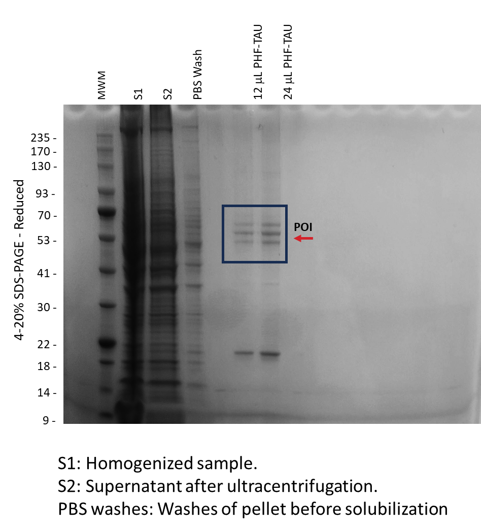 Human PHF-tau