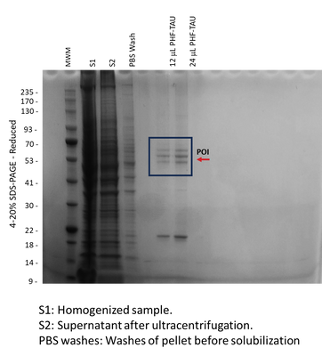 Human PHF-tau