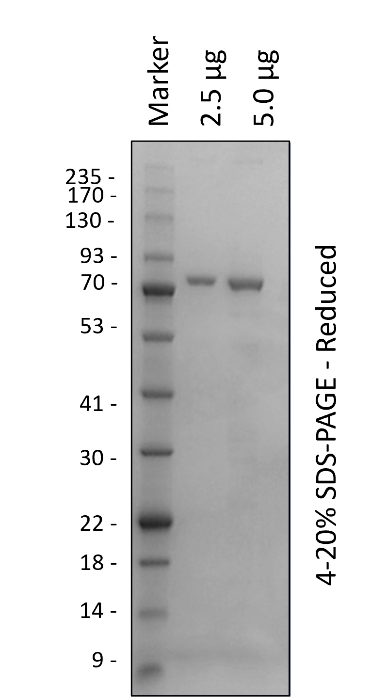 Human IKKα-(10-660)