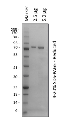 Human IKKα-(10-660)