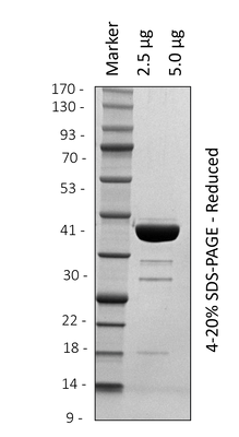 Human p38 (1-360)
