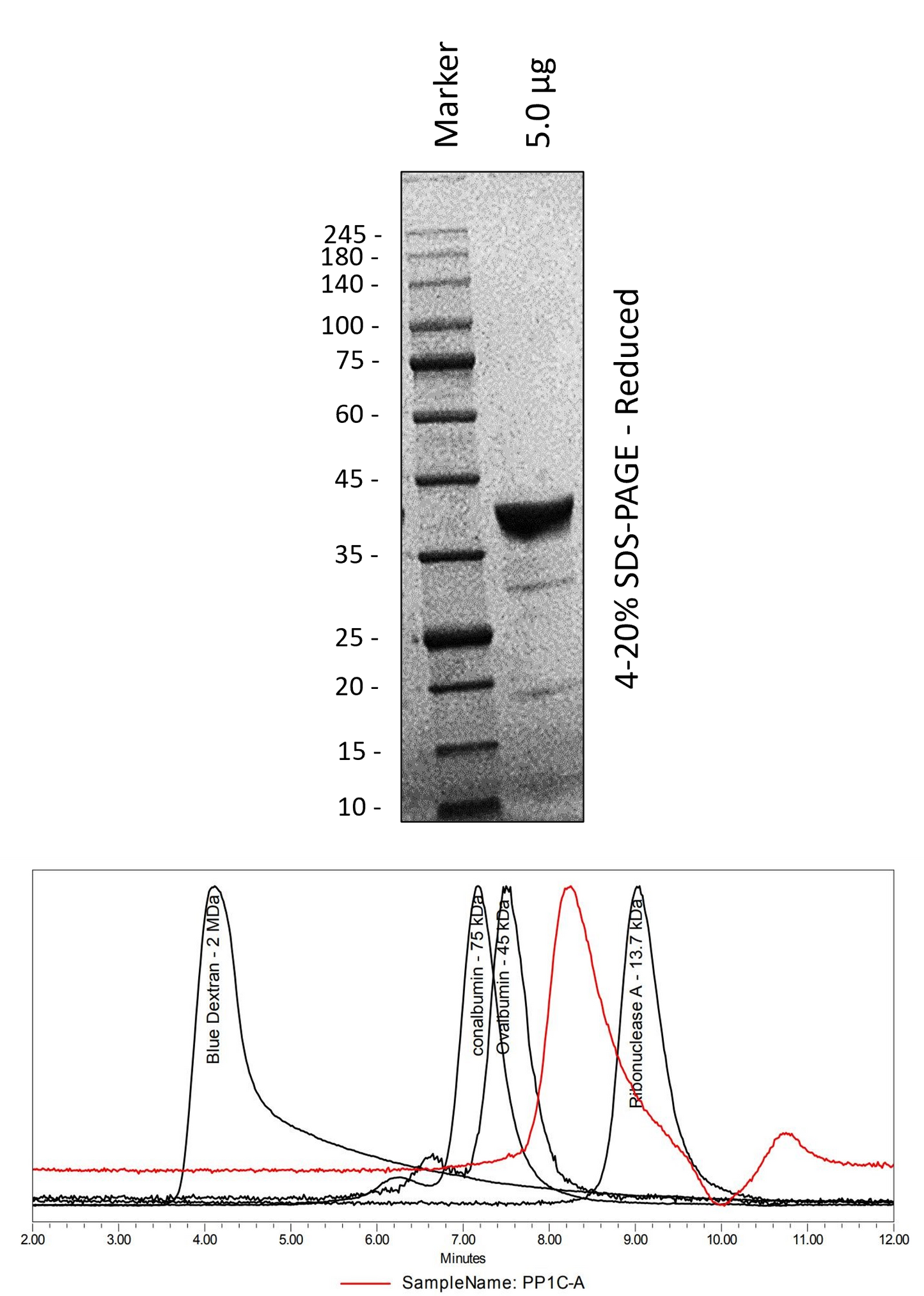 Human PP1C