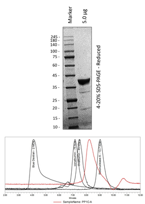 Human PP1C