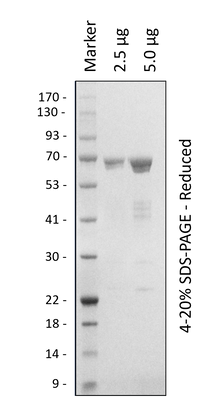 Human PLK1 (WT)